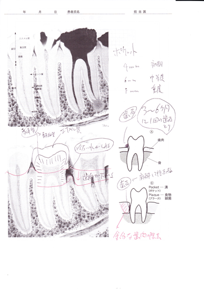 治療説明資料